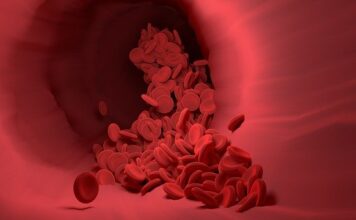 What is low blood pressure